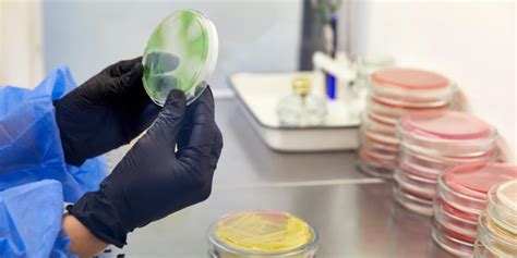 8.1: Introduction to Bacterial Identification using Culture .